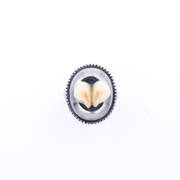 RING ANNA – Bild 5