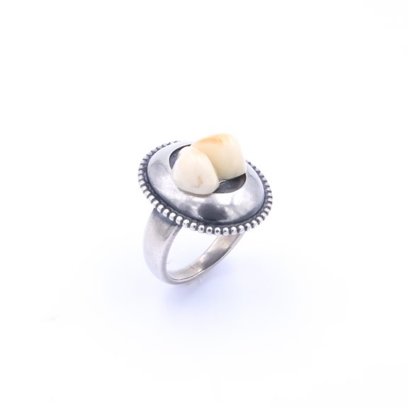 RING ANNA – Bild 3
